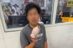 Cảnh sát giao thông dẫn đường cho nạn nhân bị tai nạn đứt 4 ngón tay đi cấp cứu