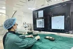 N&uacute;t mạch h&oacute;a chất điều trị ung thư gan k&eacute;o d&agrave;i sự sống