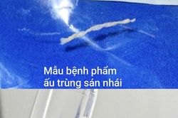 Lí do người đàn ông không ăn đồ sống vẫn bị sán