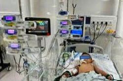 Hai bệnh viện nhi phối hợp cứu bé trai 7 tháng tuổi mắc dị vật đường thở