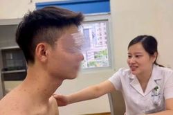 Bôi 'kem bảy màu' dưỡng da, người bệnh bất ngờ nổi mụn do corticosteroid