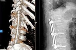 Điện giật khi sửa bóng đèn, người đàn ông ngã từ độ cao gần 4 m