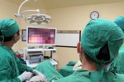Đau bụng âm ỉ, người phụ nữ 63 tuổi thủng đại tràng, áp xe ổ bụng vì xương cá