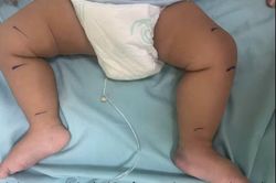 Rắn lục đuôi đỏ ẩn dưới xe đồ chơi, cắn bé 7 tháng tuổi