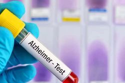 Xét nghiệm máu và chụp MRI nhanh mở hướng rút ngắn chẩn đoán Alzheimer