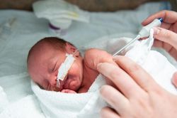Điều quyết định cơ hội sống cho trẻ sinh non