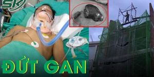 Người đàn ông đứt gan, tràn máu màng phổi sau khi ngã giàn giáo