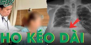 Ho kéo dài nhiều tuần, người phụ nữ bất ngờ phát hiện phổi trái xẹp hoàn toàn vì bệnh hiếm