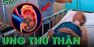 Người đàn ông 45 tuổi tá hỏa phát hiện mắc ung thư thận từ dấu hiệu đau lưng