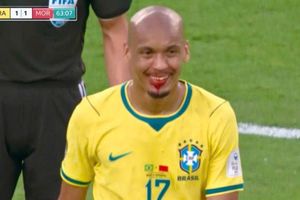 Nụ cười 'ma cà rồng' của cầu thủ Brazil viral khắp cõi mạng