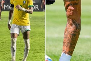 Ảnh chân trái biến dạng của Neymar hút hơn 7 triệu view