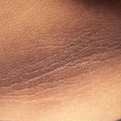Thói quen nhỏ mỗi ngày giúp 'đảo ngược' nguy cơ kháng insulin