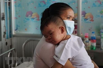 Xuất hiện ca viêm não-màng não do biến chứng của sởi