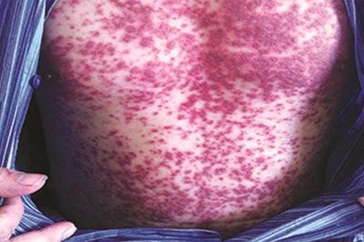 7 thay đổi trên da, càng để lâu càng nguy hiểm đến tính mạng