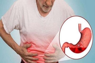 Vitamin C tăng cường miễn dịch, quá liều sẽ gây hại
