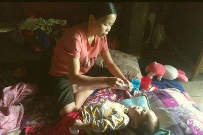 Đau lòng bé hơn 3 tuổi bị ung thư, bại não