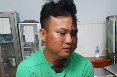 Đâm chết anh vợ từ việc vợ bỏ về nhà ngoại