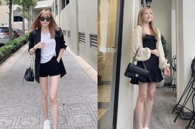 Thiều Bảo Trâm để lộ đầu gối 'củ lạc', đôi chân tong teo khiến dân mạng tò mò