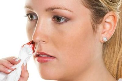 Sốt xuất huyết chảy máu cam có nguy hiểm không?