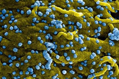 Rwanda ghi nhận thêm 7 ca nhiễm virus Marburg mới