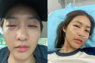 Khả Ngân nhập viện, mặt sưng vù gây lo lắng