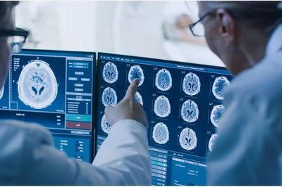 Cách AI giúp đẩy nhanh quá trình điều trị ung thư