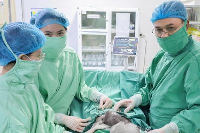 Lấy u buồng trứng to hơn cả thai nhi trong 1 lần mổ
