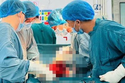Chủ quan không điều trị, người phụ nữ mang khối u tử cung 'khổng lồ' nhiều năm