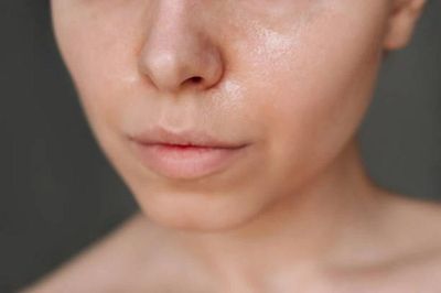 Làm thế nào để chăm sóc làn da bóng dầu, lỗ chân lông to vào mùa Hè?