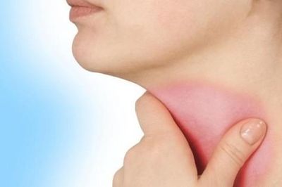 Viêm thanh quản có dẫn đến ung thư không?
