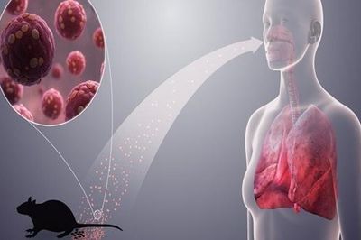 Bộ Y tế cảnh báo khẩn về loại virus lây từ chuột sau chùm ca bệnh tử vong trên tàu du lịch