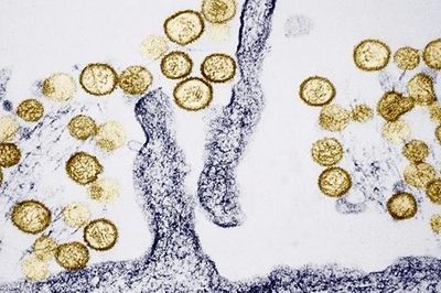 Ổ dịch virus Hanta trên tàu du lịch Đại Tây Dương tăng lên 8 ca, WHO đang truy vết
