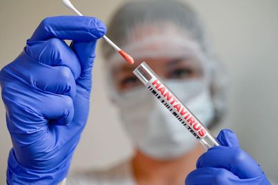 Tại sao dịch virus Hanta khác COVID-19?