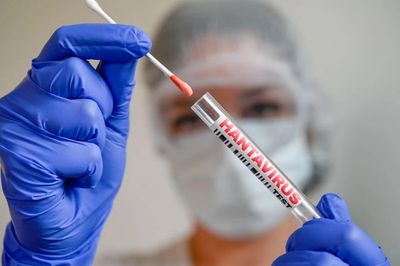 Virus Hanta khác COVID-19 như thế nào?