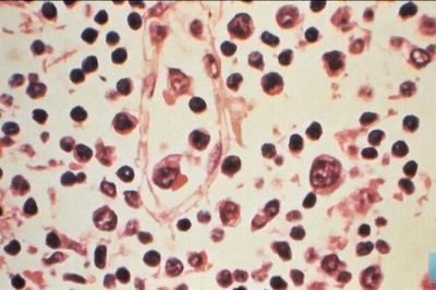 Thái Lan nâng mức cảnh báo đối với virus Hanta