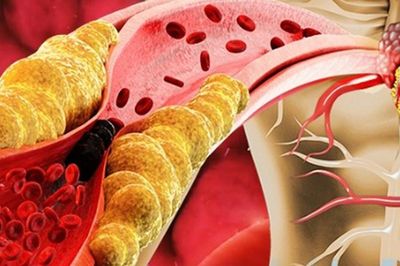 Ăn nửa quả này mỗi ngày cũng đủ trẻ hóa mạch máu, ngăn ngừa xơ cứng động mạch
