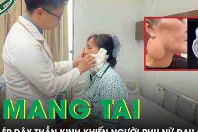 Phẫu thuật u tuyến mang tai chèn ép dây thần kinh, trả lại nụ cười cho người phụ nữ 52 tuổi