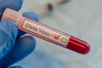 Bộ Y tế yêu cầu tăng cường phòng chống nguy cơ dịch Ebola xâm nhập Việt Nam