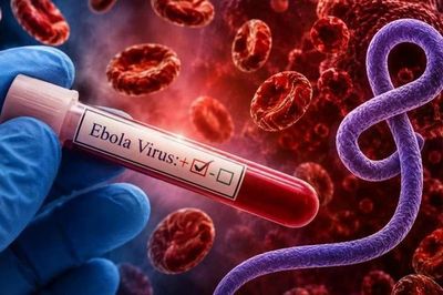 Siết kiểm soát dịch Ebola tại các cơ sở y tế, theo dõi người về từ vùng dịch