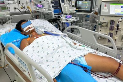 Nắng nóng, thiếu niên 15 tuổi sốc nhiệt nguy kịch, tổn thương gan, thận khi chơi thể thao
