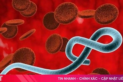 Việt Nam bổ sung thêm 6 chủng virus mới vào phác đồ điều trị bệnh Ebola