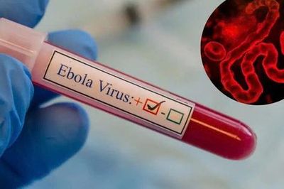 Dịch bệnh Ebola diễn biến phức tạp tại Châu Phi nhưng người dân không nên hoang mang