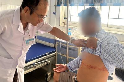 Bệnh nhân mô tả cơn đau khủng khiếp của zona thần kinh