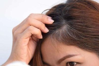 Tóc bạc sớm ở người trẻ ngày càng phổ biến: Chuyên gia cảnh báo nhiều nguyên nhân ít ai ngờ tới