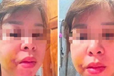 Người mẹ 3 con ở Đắk Lắk cầu cứu sau nhiều lần bị chồng hành hung