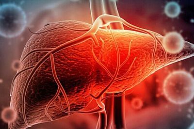Người đàn ông 40 tuổi mắc ung thư gan vì thói quen nhiều người Việt đang làm mỗi ngày