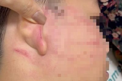 Vụ thầy giáo Ấn Độ tát học sinh lớp 4: Dừng hoạt động lớp dạy thêm