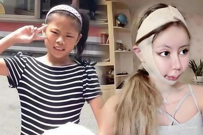 Cô gái 18 tuổi 'dao kéo' hơn 100 lần giờ ra sao?