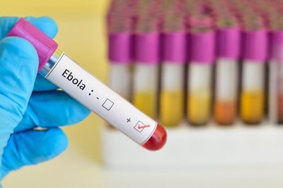 Nguyên tắc '2 - 5 - 30' ngăn Ebola lây lan