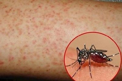 Hơn 1.100 ca mắc sốt xuất huyết, Lâm Đồng kích hoạt các biện pháp phòng, chống dịch